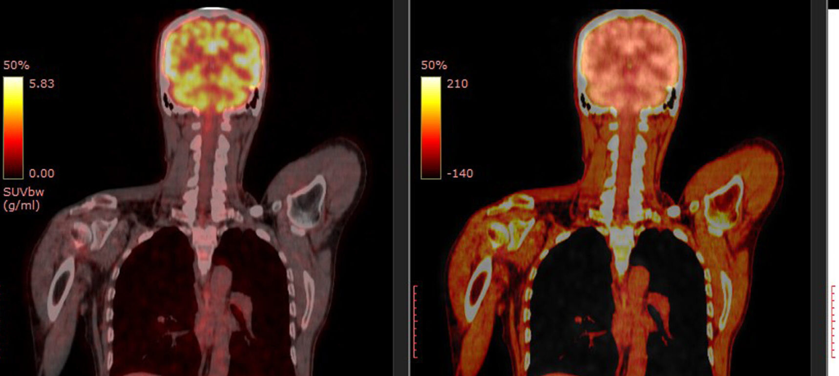 Profissional apontando modelo atômico luminoso, simbolizando radiofármacos e teranóstico na Pós-graduação em Medicina Nuclear.